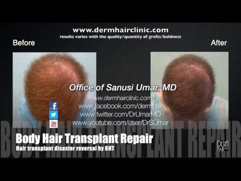 how to repair hair follicles