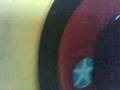 Mega do�um g�n�