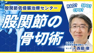寛骨臼骨切り術 (SPO/CPO/RAO)