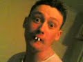Toms Buck Teeth Toms Buck Teeth