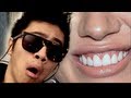 Why I Have Yellow Teeth