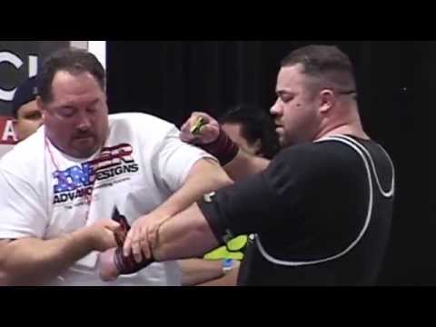 Le explotan los ójos por sobre esfuerzo