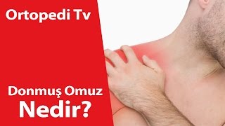 Deniz Algün-17