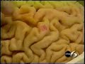 BrainGate Neural Interface