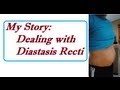 OBM: I'm finally coming out! (Tummy Tuck or Tupler Technique for Diastasis Recti)