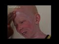 White Negros - South Africa