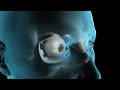 Glaucoma-Surgery