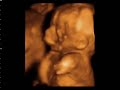 19 semanas 19 semanas