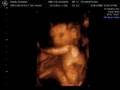 Prenatal Merrianna Jean Dahlin