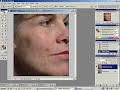 Acne Correction in Photoshop