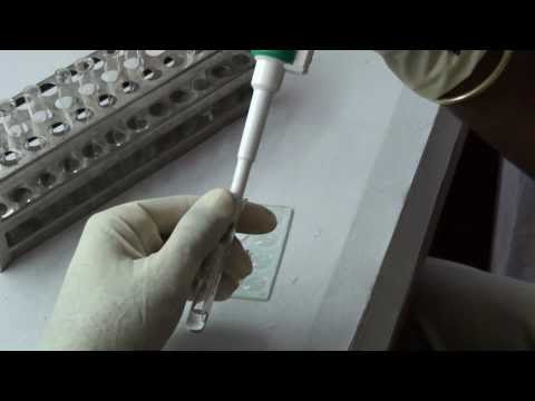 how to treat a positive rpr