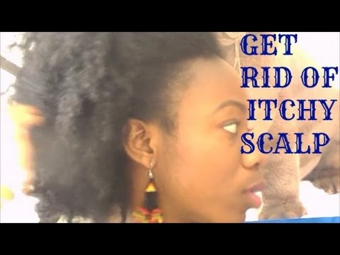 how to help itchy scalp