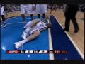 Dirk Nowitzki sprains left ankle!! 23/3/08 Dirk Nowitzki sprains left ankle!! 23/3/08