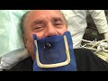 Patient with Root Canal