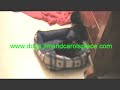Yorkie Puppies Playing