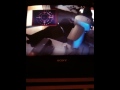 My LASIK procedure!