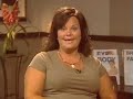 Liposuction and Tummy Tuck by Dr. Robert Wald of Fullerton Liposuction and Tummy Tuck by Dr. Robert Wald of Fullerton