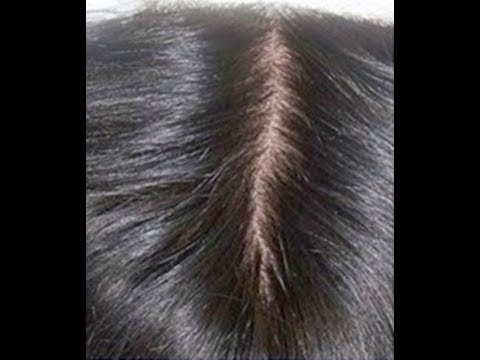 how to whiten aluminum