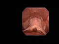 High Resolution Upper Airway Anatomy