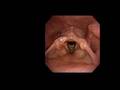High Resolution Upper Airway Anatomy