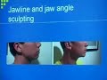 Non Surgical Cosmetic Procedures UCLA Dr. Alexander Rivkin Non Surgical Cosmetic Procedures UCLA Dr. Alexander Rivkin