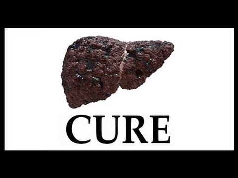 how to cure cirrhosis