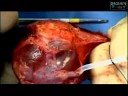 Click here to watch this video Egyptian Conjoined Twins, Part 1