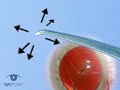Forceps Alone Phaco basic techniques