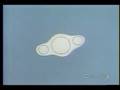 Atomen pulsed microwave health match