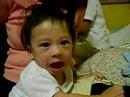 albern ko
