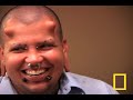 Taboo? Flesh Branding