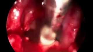 Carlos Takahiro Chone-3