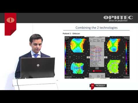 How to improve results with the Precizon Toric by evaluating astigmatism with a new Led topographer 