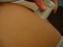 Pregnancy Untrasound