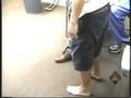 Ataxia