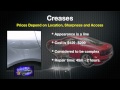 Dayton Car Door Ding Removal | Hail Damage Repair Cincinnati Ohio | Dent Magic John