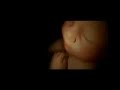Licencia de maternidad Licencia de maternidad
