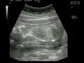 meu bebe com 16 semanas meu bebe com 16 semanas