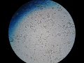Trichodina Parasite
