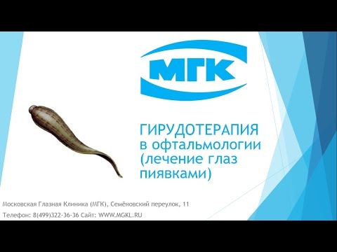 Видео Гирудотерапия (лечение с использованием пиявок)