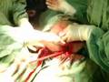 Discovery Channel - In The Womb Discovery Channel - In The Womb
