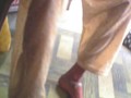A case of hemiplegia cured By Hair Transmission