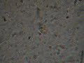 Intestinal parasitic protozoa