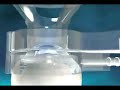 Lasik