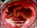 Gravidez - Desenvolvimento Fetal