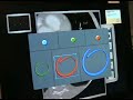 medical consolle based on eye-tracking