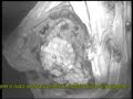 videoispezione con vesponi
