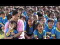 Down syndrome:&nbsp;Down  Syndrome: Que Sera, Sera by Thai Nursery school children
