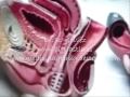 Bioplastia del placer sexual  Punto G vaginal y aumento del grosor del  pene. Dr Gálvez .Macrolane