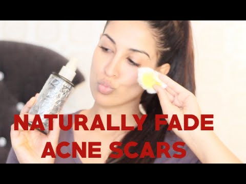 how to make acne scars fade